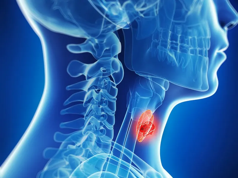 Oral Fibroma visual display