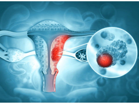 How Modern Medicine Is Changing the Future of Cervical and Anal Cancer Care