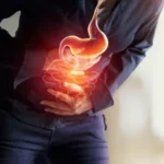 Is It Just Indigestion? Understanding Acid Reflux and Abdominal Pain
