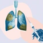 Beyond Antibiotics: Why Vaccines Are Key in Fighting Pneumonia