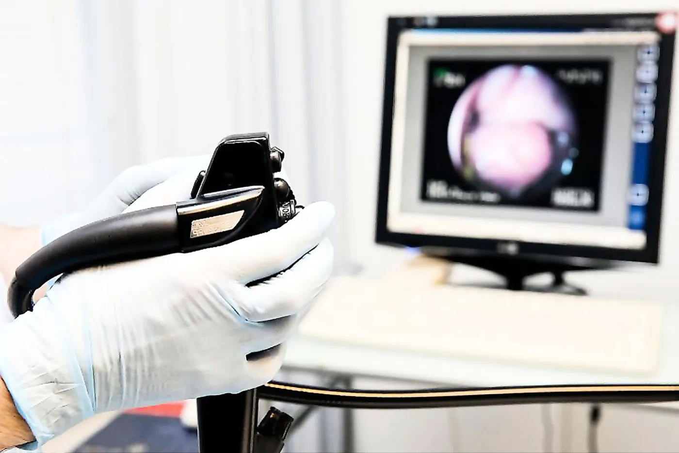 How to Prepare for Your Upper Endoscopy Procedure?