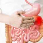 How a Leaky Gut May Be Linked to Brain Fog and Chronic Fatigue Syndrome