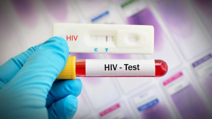 HIV Treatment & PrEP Services in Ridgewood: Comprehensive Sexual Health Care