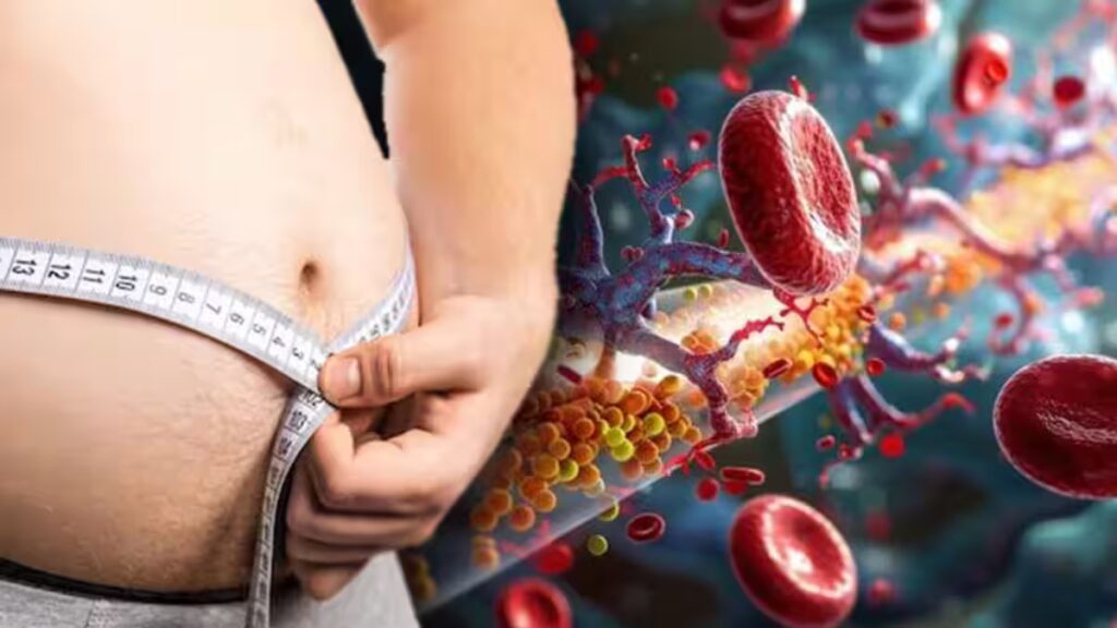 Why Obesity Awareness Campaigns Are Critical for Public Health