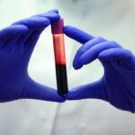 Why the Body Feels Weak Even When Blood Tests Are Normal