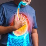 How Sleeping Position Can Influence Acid Reflux Symptoms