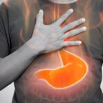Can Acid Reflux Cause Chronic Cough and Throat Irritation?